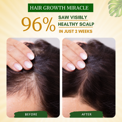 Rosemary Leaves and Rosemary Water for Hair Growth | 100% Pure, Natural and Organic