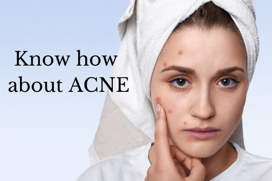 acne and oily prone skin