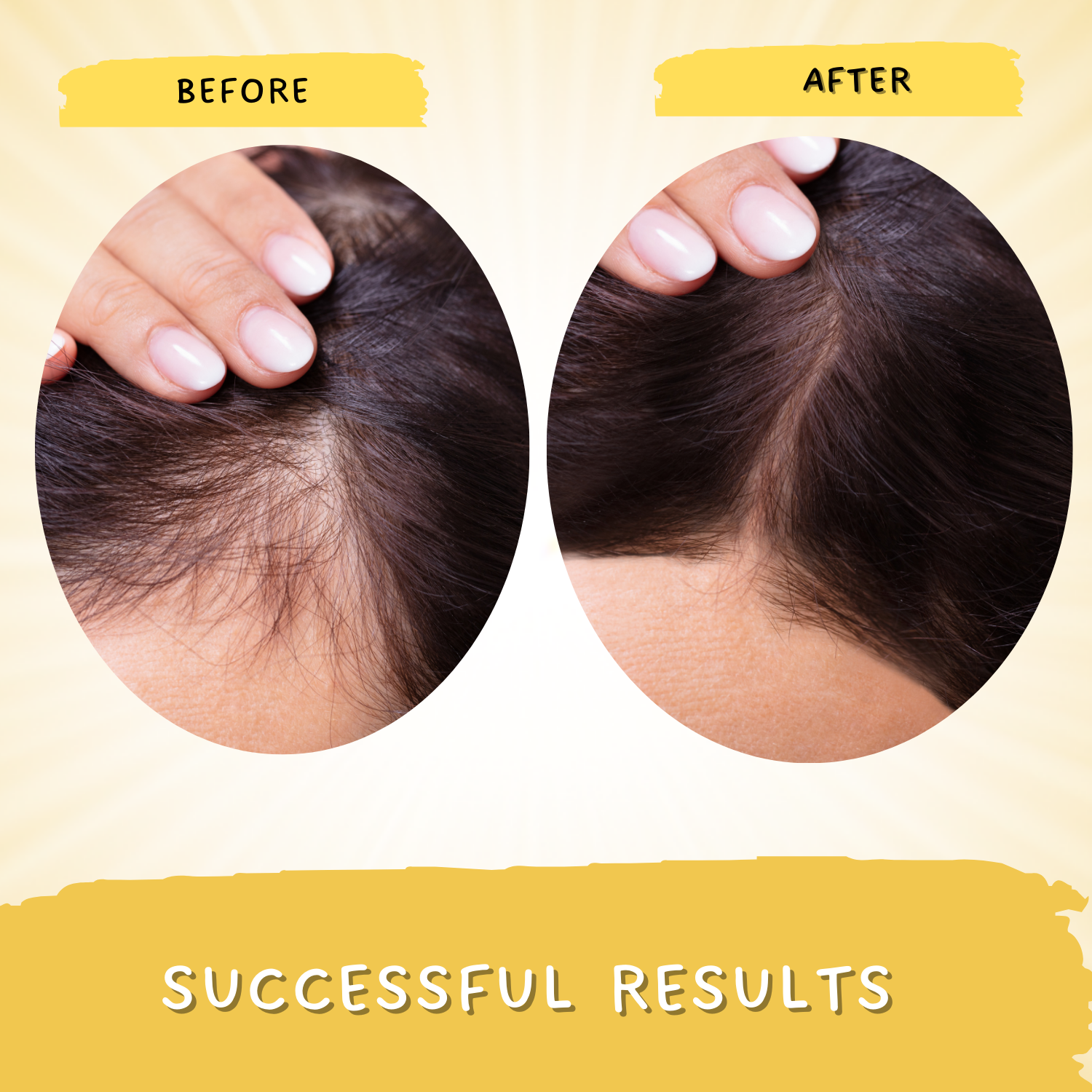Rosemary Hair Growth Serum | Strengthens Hair Follicles, Prevents Hair Fall | Men & Women