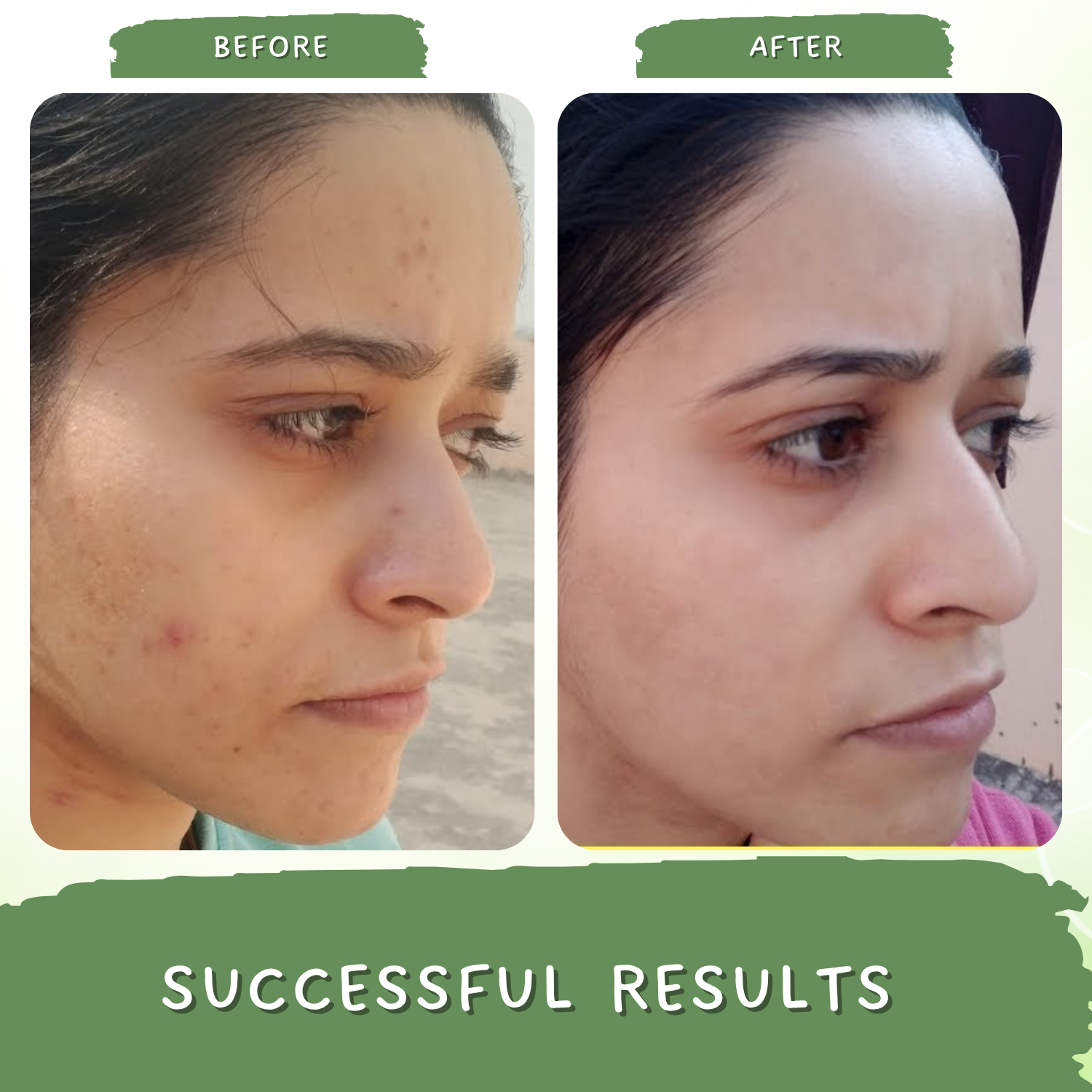 Green Coffee Blemish Clear Face Pack/Mask for Brightening, Tan Removal and Glowing Skin