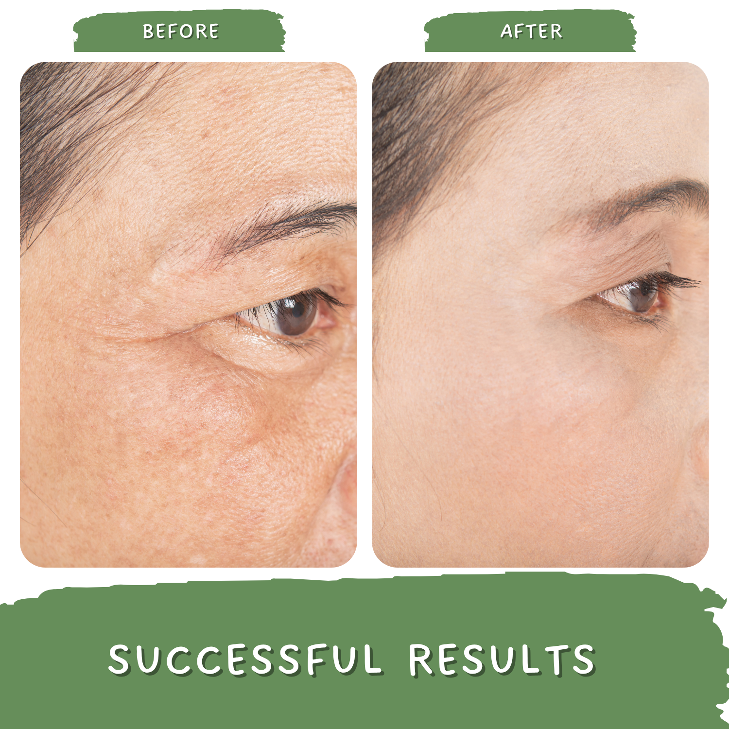 Timeless- Day & Night Anti Aging Cream for Women and Men | Treat Wrinkles and Fine Lines