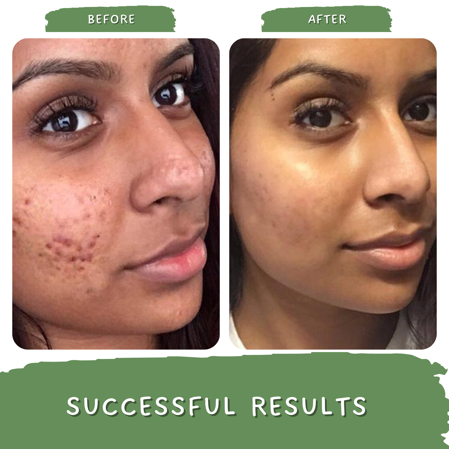 Green Coffee Blemish Clear Scrub for Men and Women | Exfoliating Scrub for Pigmentation & Dark Spots
